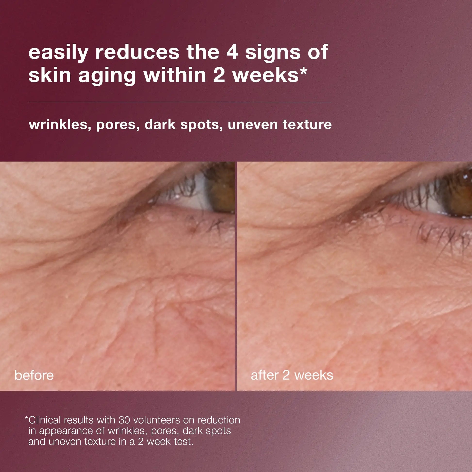 Dermalogica Dynamic Skin Retinol Serum (7631293087904)